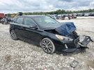 2018 Hyundai Elantra Alternator Hatchback Gt 0L Id 373002E320. Fixed Price $93.10.