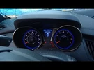 Alternator Coupe Fits 13-14 Genesis 1567961. Fixed Price $95.00.